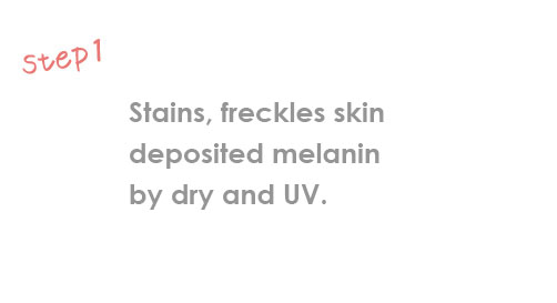 今まで蓄積した、乾燥や紫外線などによって、メラニン色素が沈着していまい、シミ・そばかすができた肌の状態。　